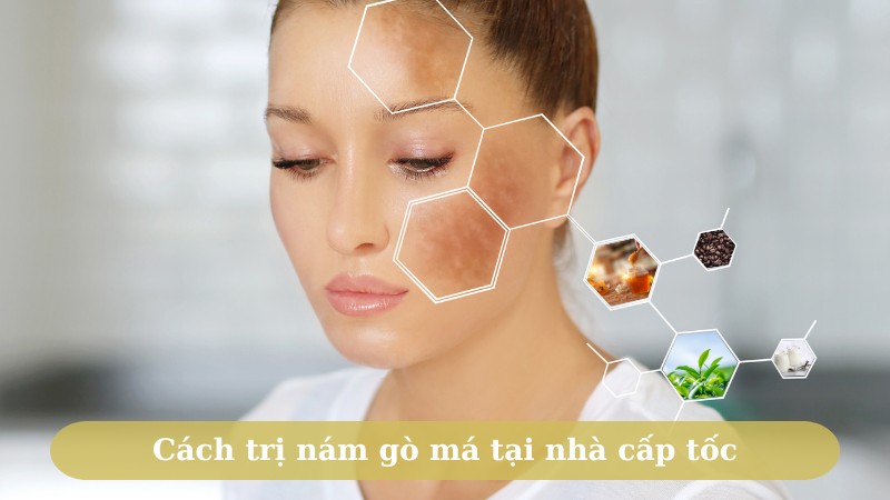 Tong hop nhung cach tri nam go ma tai nha