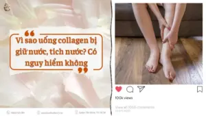 Uong collagen bi giu nuoc
