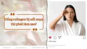Uong collagen bi noi mun